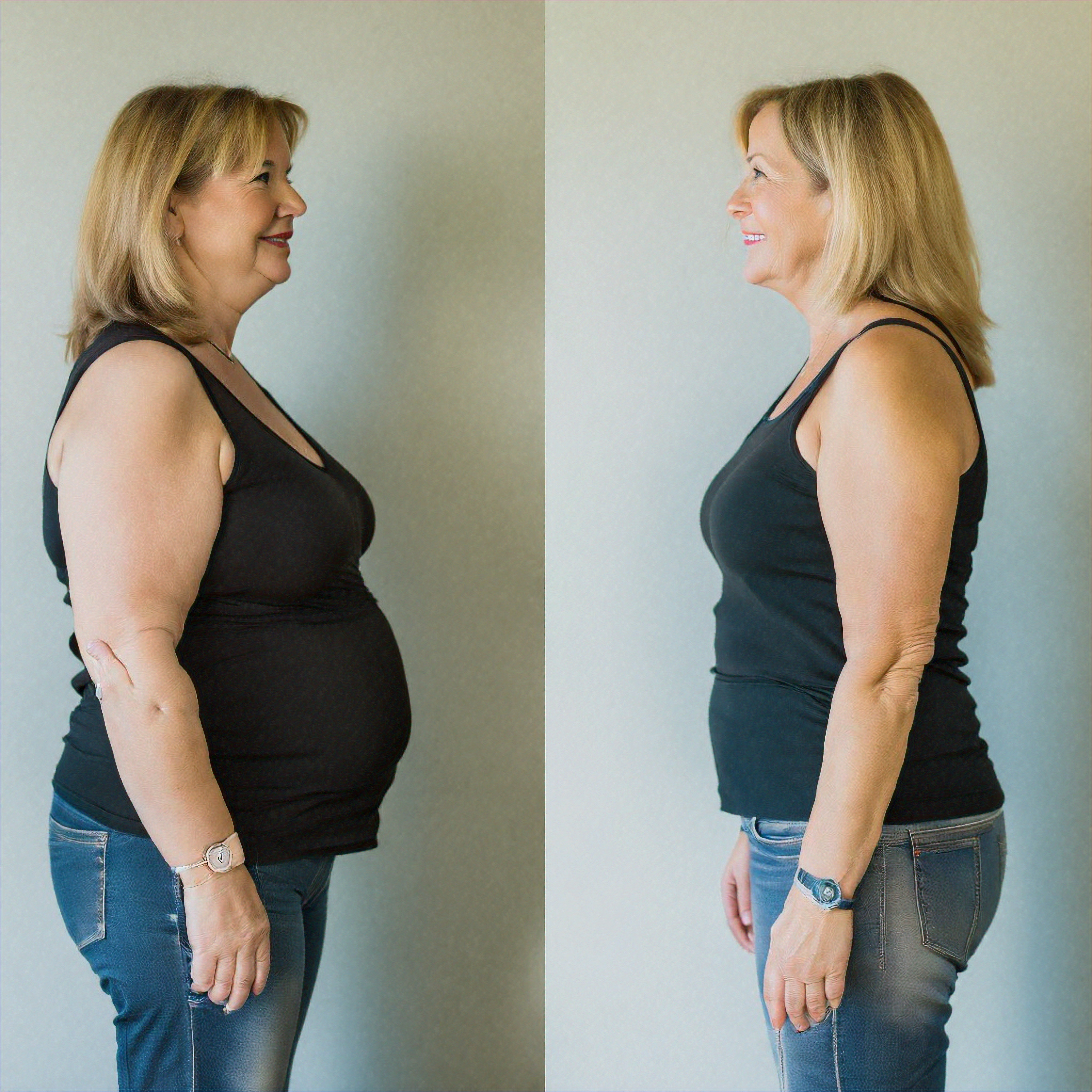 Prima e dopo dimagrimento