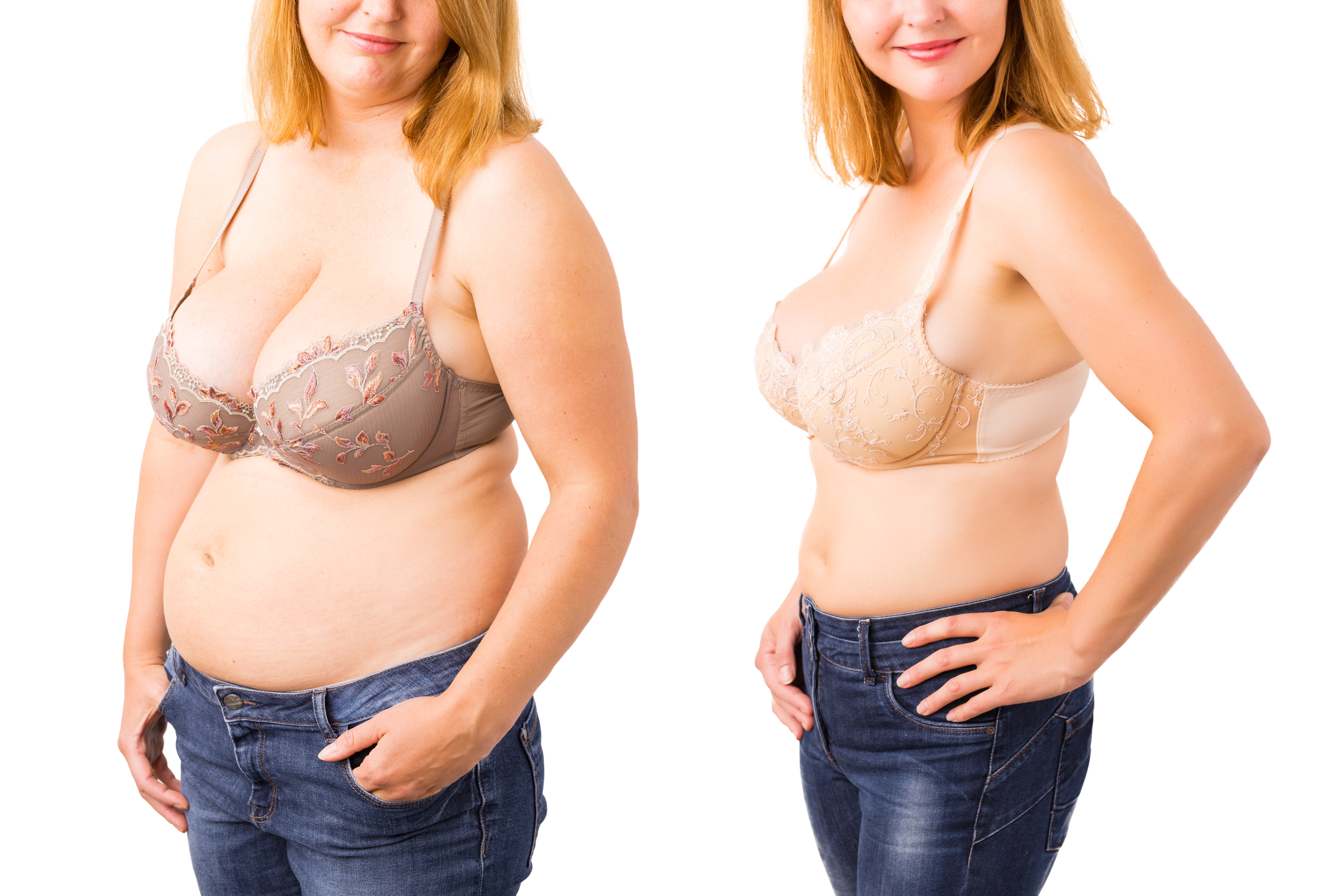 Prima e dopo dimagrimento