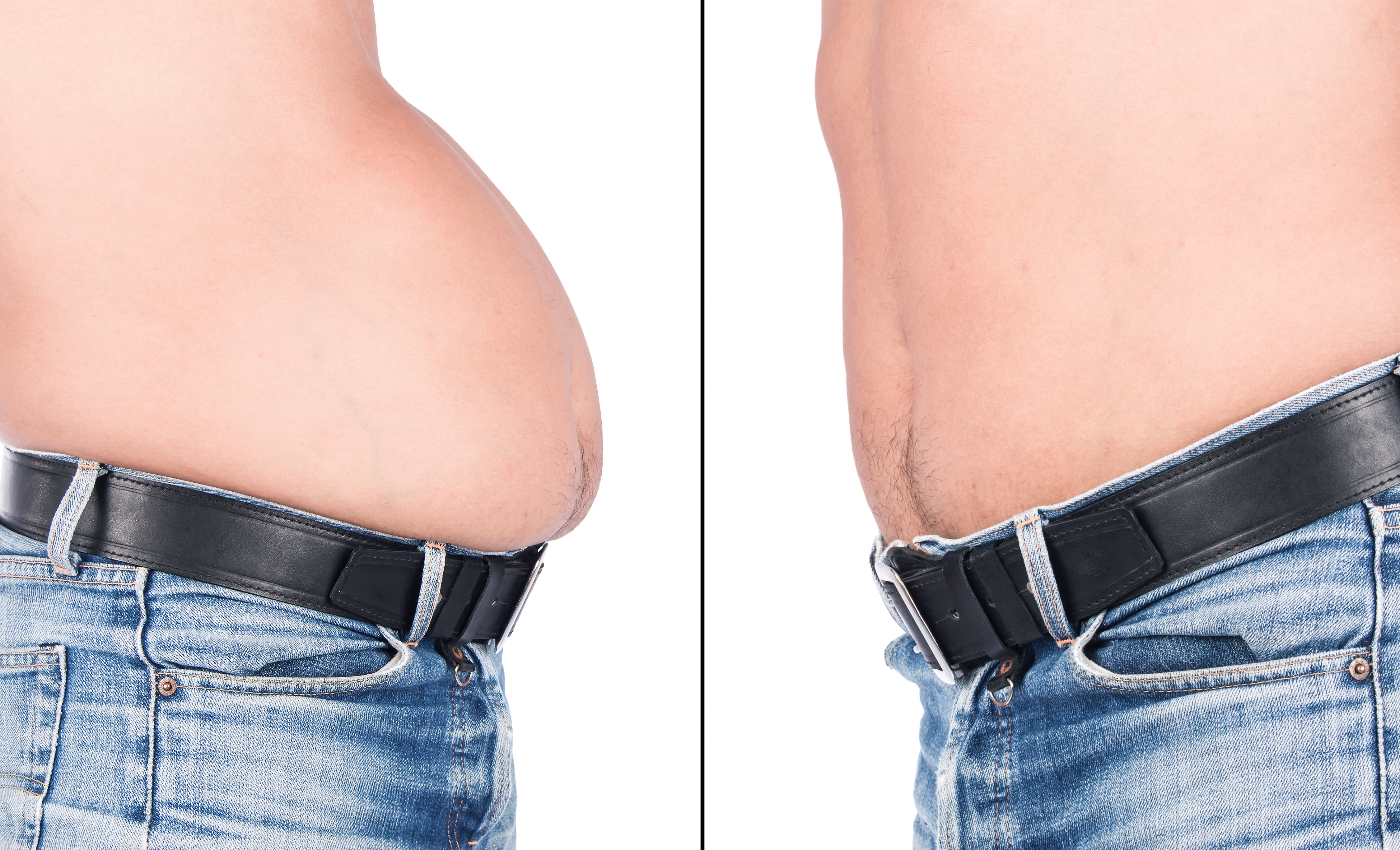 Prima e dopo dimagrimento